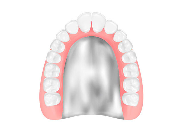 コバルトクロム床義歯